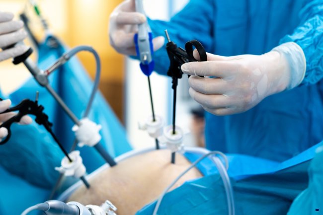 cirurgia-minimamente-invasiva