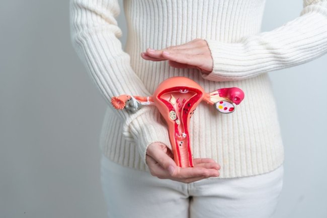 como-tratar-mioma-uterino